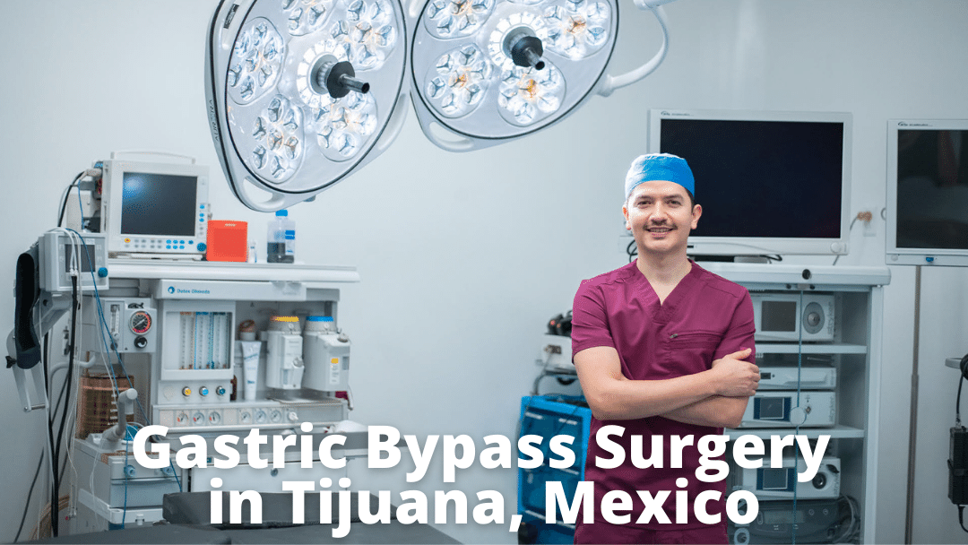 Gastric Bypass Surgery in Tijuana, Mexico